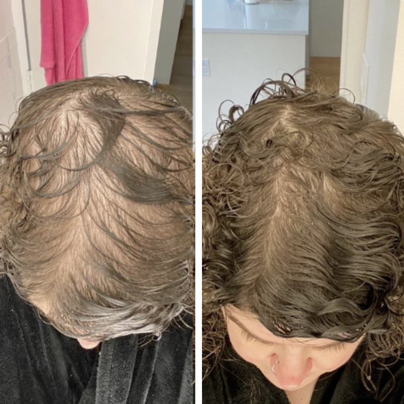 Resultaat na 6 maanden