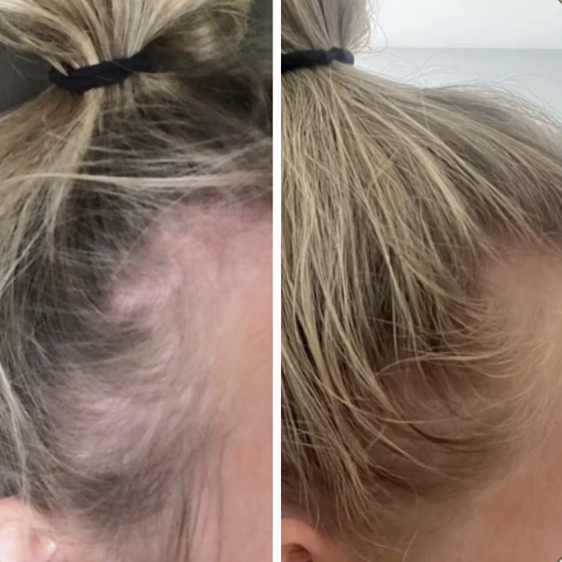 Resultaat na 3 maanden